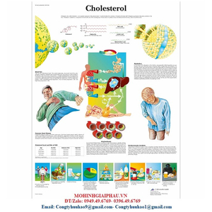 Tranh, biểu đồ Cholesterol
