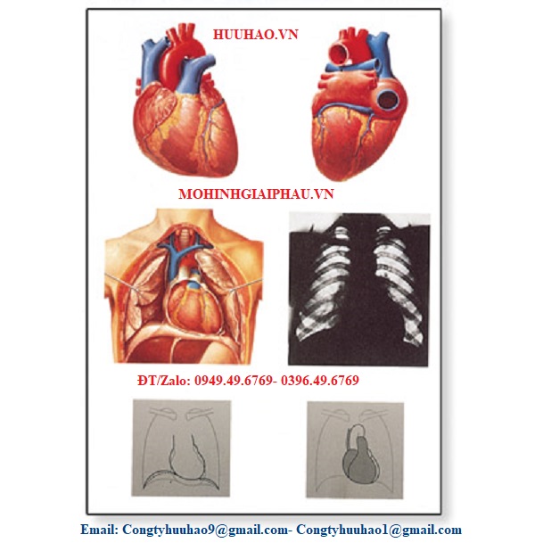 TRANH, BIỂU ĐỒ GIẢI PHẪU TIM