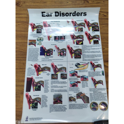 Tranh giải phẫu tai (Ear Disorders)
