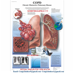 Tranh, Biểu đồ COPD, Bệnh phổi tắc nghẽn mạn tính