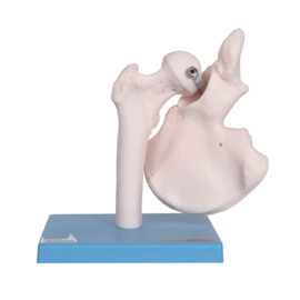 Mô hình khớp hông