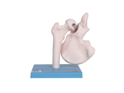 Mô hình khớp hông