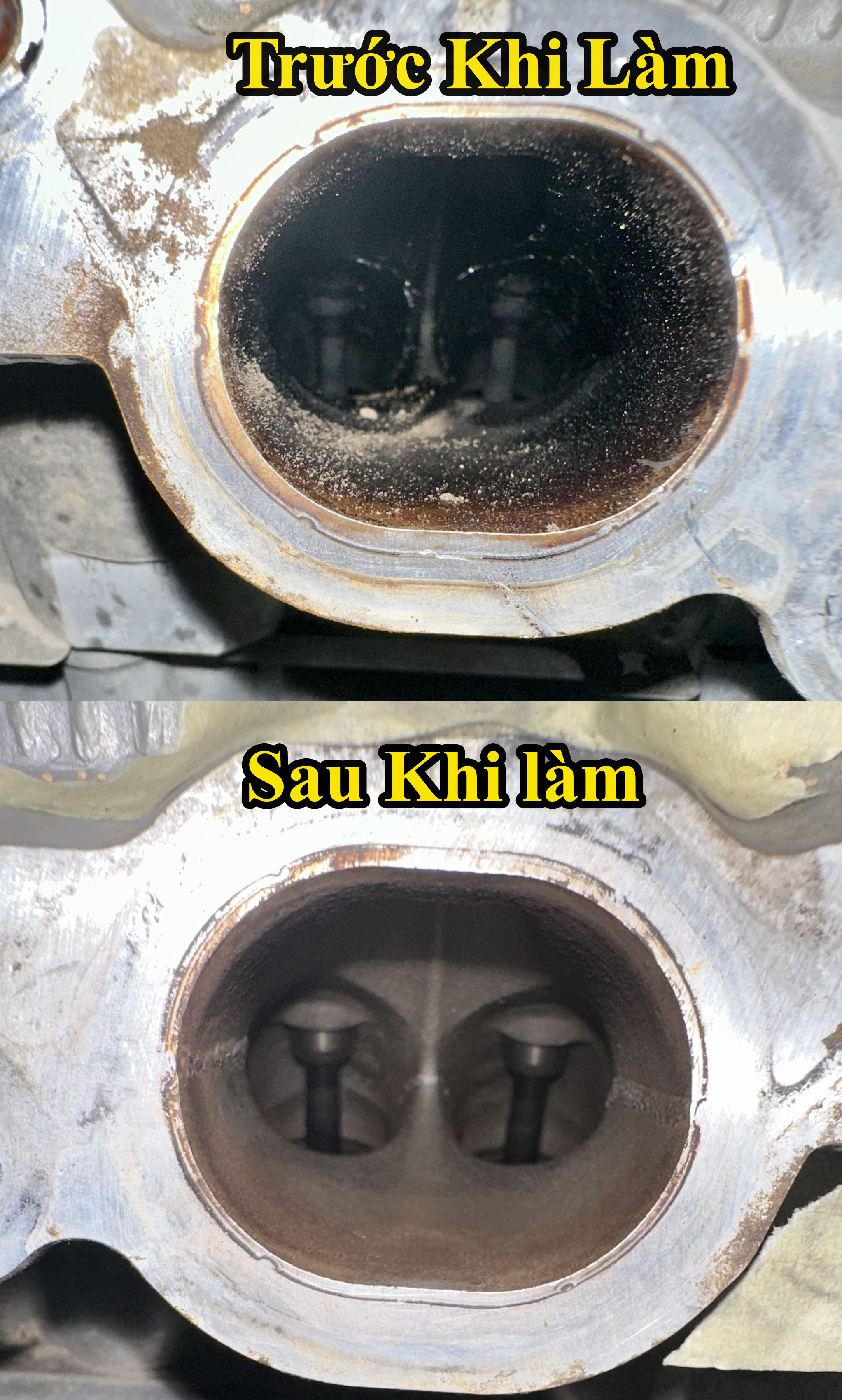 trước và sau khi bắn trấu họng nạp