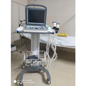 xe đẩy máy siêu âm