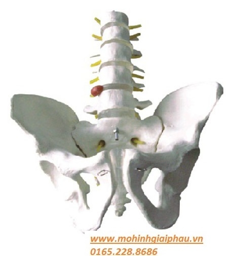 Mô hình khung chậu và 5 đốt sống thắt lưng